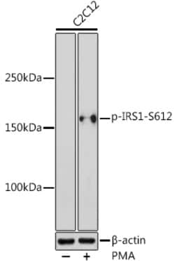 Phospho-IRS1 (Ser612) Polyclonal Antibody:Antibodies, Polyclonal