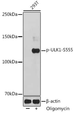 Invitrogen Phospho-ULK1 (Ser555) Polyclonal Antibody 100 &mu;L; Unconjugated:Anticorps,