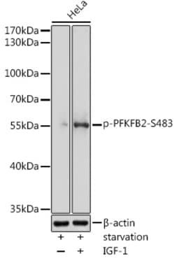 Invitrogen Phospho-PFKFB2 (Ser483) Polyclonal Antibody 100 &mu;L; Unconjugated:Antibodies,