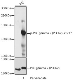 Phospho-PLCG2 (Tyr1217) Polyclonal Antibody, Invitrogen 100 &mu;L; Unconjugated:Antibodies,