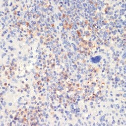 Phospho-PLCG2 (Tyr1217) Polyclonal Antibody, Invitrogen 100 &mu;L; Unconjugated:Antibodies,