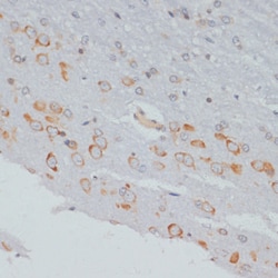 Phospho-CrkL (Tyr207) Polyclonal Antibody:Antibodies, Polyclonal