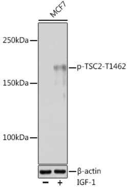 Invitrogen Phospho-TSC2 (Thr1462) Polyclonal Antibody 100 &mu;L; Unconjugated:Antibodies,