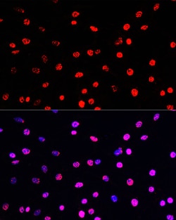 Invitrogen Phospho-Histone H3 (Thr45) Polyclonal Antibody 100 &mu;L; Unconjugated:Antibodies,