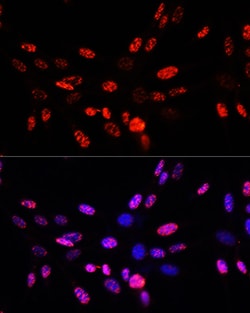 Invitrogen Phospho-Histone H3 (Thr45) Polyclonal Antibody 100 &mu;L; Unconjugated:Antibodies,