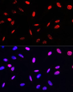 Invitrogen Phospho-Histone H3 (Thr45) Polyclonal Antibody 100 &mu;L; Unconjugated:Antibodies,