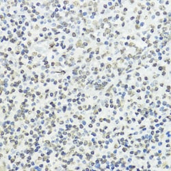 Invitrogen Phospho-Histone H3 (Thr45) Polyclonal Antibody 100 &mu;L; Unconjugated:Antibodies,