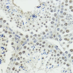 Invitrogen Phospho-Histone H3 (Thr45) Polyclonal Antibody 100 &mu;L; Unconjugated:Antibodies,