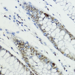 Invitrogen Phospho-Histone H3 (Thr6) Polyclonal Antibody 100 &mu;L; Unconjugated:Antibodies,