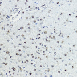 Invitrogen Phospho-Histone H3 (Thr6) Polyclonal Antibody 100 &mu;L; Unconjugated:Antibodies,