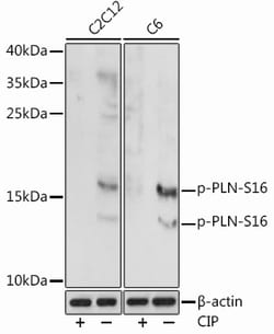 Invitrogen Phospho-Phospholamban (Ser16) Polyclonal Antibody 100 &mu;L;