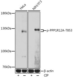 Phospho-MYPT1 (Thr853) Polyclonal Antibody:Antibodies, Polyclonal