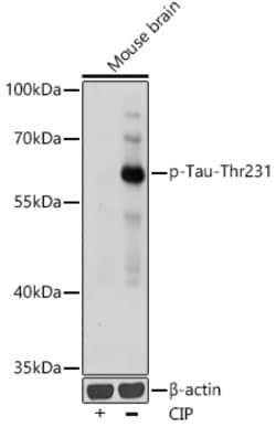Invitrogen Phospho-Tau (Thr231) Polyclonal Antibody 100 &mu;L; Unconjugated:Antibodies,