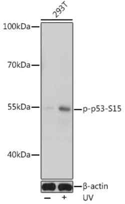 Invitrogen Phospho-p53 (Ser15) Polyclonal Antibody 100 &mu;L; Unconjugated:Antibodies,