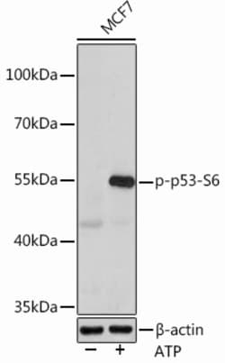 Invitrogen Phospho-p53 (Ser6) Polyclonal Antibody 100 &mu;L; Unconjugated:Antibodies,
