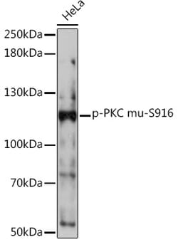 Phospho-PKC mu (Ser916) Polyclonal Antibody, Invitrogen 100 &mu;L; Unconjugated:Antibodies,