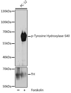 Invitrogen Phospho-Tyrosine Hydroxylase (Ser40) Polyclonal Antibody 100