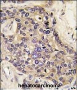 Invitrogen HGF Polyclonal Antibody 400 &mu;L; Unconjugated:Antikörper