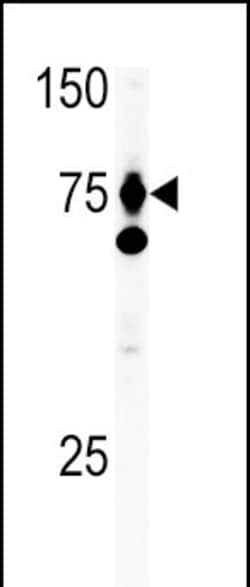 Invitrogen HGF Polyclonal Antibody 400 &mu;L; Unconjugated:Antikörper