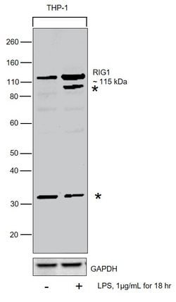 Invitrogen RIG-I Polyclonal Antibody 400 &mu;L; Unconjugated:Antibodies,
