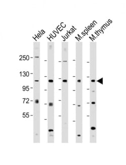 Invitrogen RIG-I Polyclonal Antibody 400 &mu;L; Unconjugated:Antibodies,