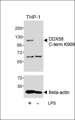 Invitrogen RIG-I Polyclonal Antibody 400 &mu;L; Unconjugated:Antibodies,