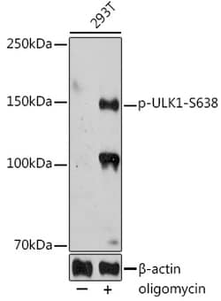 Invitrogen Phospho-ULK1 (Ser638) Polyclonal Antibody 100 &mu;L; Unconjugated:Antibodies,