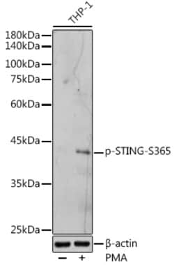 Phospho-STING (Ser365) Polyclonal Antibody:Antibodies, Polyclonal