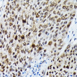 Invitrogen Phospho-FOXO3A (Ser425) Polyclonal Antibody 100 &mu;L; Unconjugated:Antibodies,