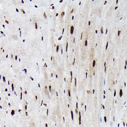 Invitrogen Phospho-FOXO3A (Ser425) Polyclonal Antibody 100 &mu;L; Unconjugated:Antibodies,