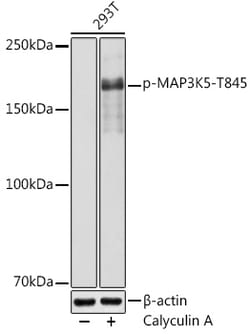 Invitrogen Phospho-ASK1 (Thr845) Polyclonal Antibody 100 &mu;L; Unconjugated:Antibodies,