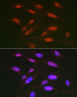 Invitrogen Phospho-c-Jun (Thr91) Polyclonal Antibody 100 &mu;L; Unconjugated:Antibodies,