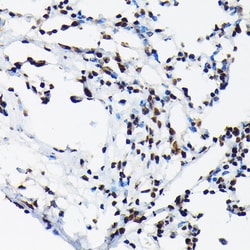 Invitrogen Phospho-c-Jun (Thr91) Polyclonal Antibody 100 &mu;L; Unconjugated:Antibodies,