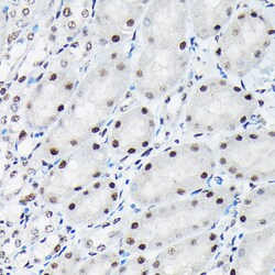 Invitrogen Phospho-c-Jun (Thr91) Polyclonal Antibody 100 &mu;L; Unconjugated:Antibodies,