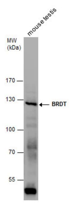 Invitrogen BRDT Polyclonal Antibody 100 &mu;L; Unconjugated:Antibodies,