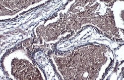 Invitrogen TMPRSS2 Polyclonal Antibody 100 μL; Unconjugated:Antibodies,