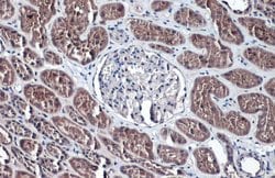 Invitrogen TMPRSS2 Polyclonal Antibody 100 μL; Unconjugated:Antibodies,