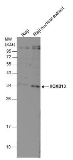 Invitrogen HOXB13 Polyclonal Antibody 100 &mu;L; Unconjugated:Antibodies,