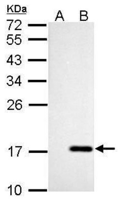Invitrogen NME4 Polyclonal Antibody 100 &mu;L; Unconjugated:Antibodies,