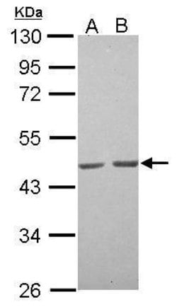 Invitrogen ACTA1 Polyclonal Antibody 100 &mu;L; Unconjugated:Antibodies,