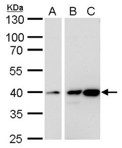 Invitrogen Calponin 3 Polyclonal Antibody 100 μL; Unconjugated:Antibodies,