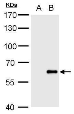 Invitrogen Influenza B Virus Polyclonal Antibody 100 &mu;L; Unconjugated:Antibodies,