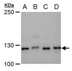Invitrogen XPF Polyclonal Antibody 100 &mu;L; Unconjugated:Antibodies,