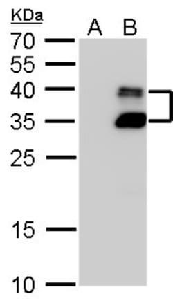 Invitrogen BarX1 Polyclonal Antibody 100 &mu;L | Buy Online | Invitrogen&trade; | Fisher Scientific