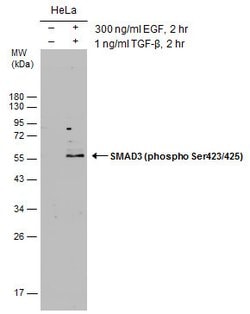 Invitrogen Phospho-SMAD3 (Ser423, Ser425) Polyclonal Antibody 100 &mu;L;