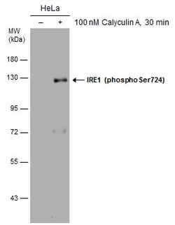 Invitrogen Phospho-IRE1 alpha (Ser724) Polyclonal Antibody 100 &mu;L | Buy Online | Invitrogen&trade; | Fisher Scientific