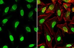Invitrogen PPM1D Polyclonal Antibody 100 &mu;L; Unconjugated:Antibodies,