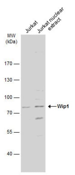 Invitrogen PPM1D Polyclonal Antibody 100 &mu;L; Unconjugated:Antibodies,
