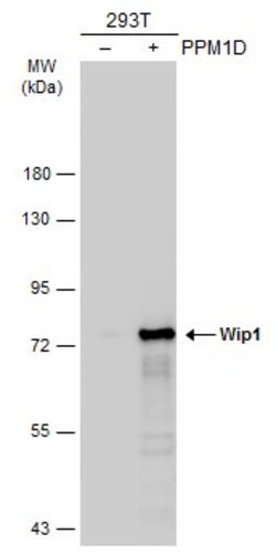 Invitrogen PPM1D Polyclonal Antibody 100 &mu;L; Unconjugated:Antibodies,