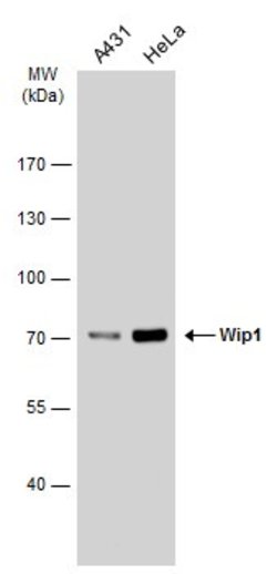 Invitrogen PPM1D Polyclonal Antibody 100 &mu;L; Unconjugated:Antibodies,